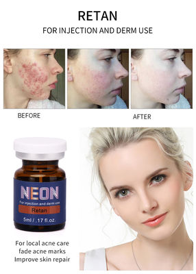 Essenza pura di terapia del siero dell'iniezione 5ml dell'acne del siero meso al neon di trattamento