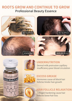 Prevenzione della perdita dei capelli Siero di crescita dei capelli