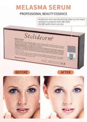 OEM Stalidearm Anti-melasma Sero sbiancante del viso Anti-invecchiamento Collagene idratante Essenza di rimozione delle lentiggini