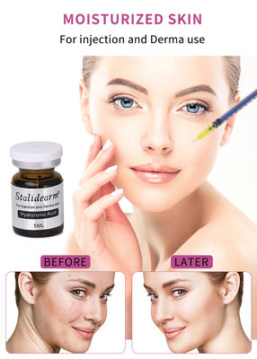 Cosmetic Beauty 5 ml Antiaging Microneedling Acido ialuronico Iniezione di riempimento