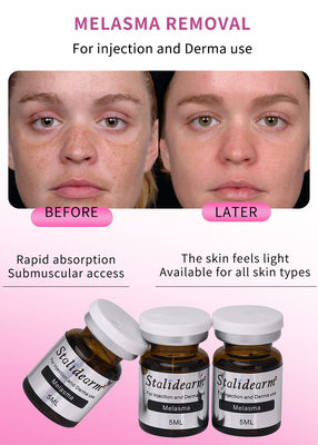 5 ml anti-melasma siero liquido set per iniezione con personalizzazione OEM