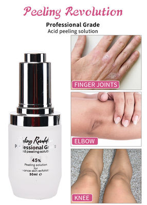 Soluzione di peeling acido di qualità professionale Set liquido per esfoliazione del viso