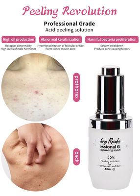 Serum di esfoliazione della pelle di qualità professionale Set di prodotti per la cura della pelle Pulizia Ristrutturazione della pelle Rivitalizzare Soluzione esfoliante