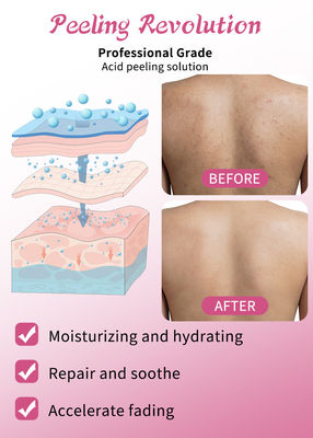 Serum di esfoliazione della pelle di qualità professionale Set di prodotti per la cura della pelle Pulizia Ristrutturazione della pelle Rivitalizzare Soluzione esfoliante