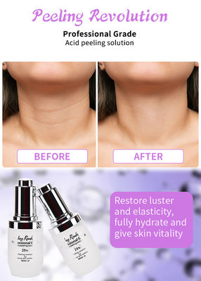 Serum per esfoliare il viso di qualità professionale per peeling della pelle