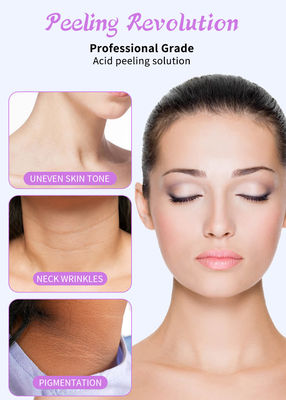 Serum per esfoliare il viso di qualità professionale per peeling della pelle