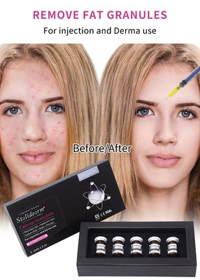 Stalidearm Riempitivi Dermici Trattamento Acne Siero iniettabile per la guarigione dell' acne e la riduzione delle macchie