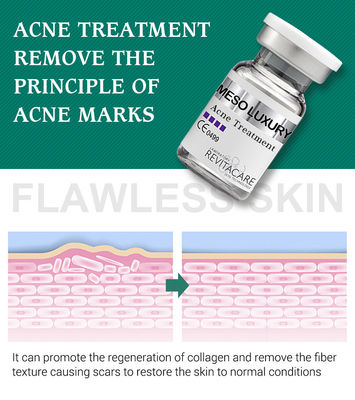 Chiaro siero del brufolo puro della pianta che imbianca trattamento Mesotherapy per le cicatrici dell'acne