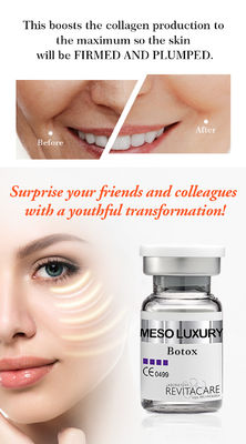 imbiancatura del siero MESO di Mesotherapy del siero di Microneedling del siero di BOTOX per il fronte
