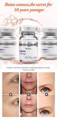 imbiancatura del siero MESO di Mesotherapy del siero di Microneedling del siero di BOTOX per il fronte