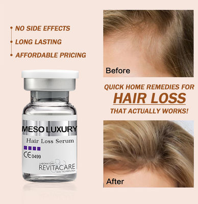Etichetta privata su ordinazione naturale di erbe di trattamento 10ml del siero di ricrescita dei capelli