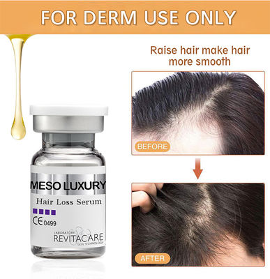 Etichetta privata su ordinazione naturale di erbe di trattamento 10ml del siero di ricrescita dei capelli