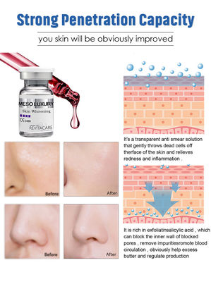 Il siero meso DI LUSSO Microneedling immediatamente ha assorbito la pelle che imbianca l'essenza 10ML