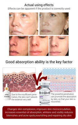 Alleggerimento consolidando il siero meso dell'essenza del caviale di Microneedling Mesotheraphy del siero