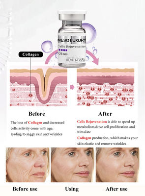 Cellula mesa che ringiovanisce il siero Microneedling antinvecchiamento di potere per l'imbiancatura della pelle
