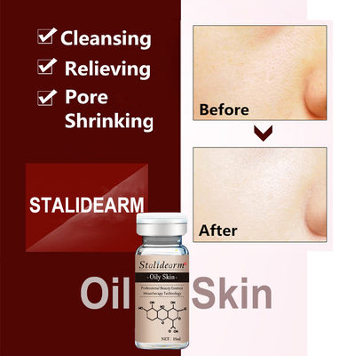 Siero Microneedle Mesoterapia Trattamento Acne Anti Acne Etichetta Personalizzata Penna Dermica Essenza Viso Per Pelle Grassa
