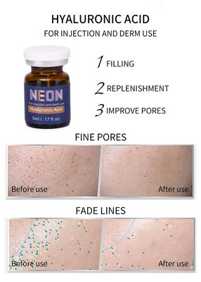 Imbiancando la pelle mesa del siero di terapia che alleggerisce le iniezioni acide ialuroniche 5ml antinvecchiamento