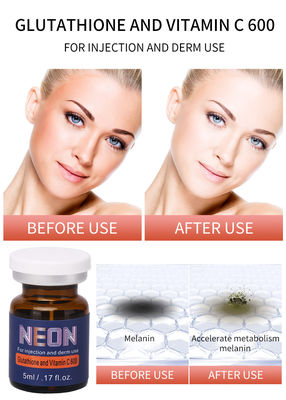 pelle Colleen Fitzpatrick che imbianca il glutatione AL NEON di Mesotherapy del siero