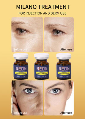 Il nero al neon della lentiggine del siero meso di terapia di Milano macchia il siero del trattamento di Melasma