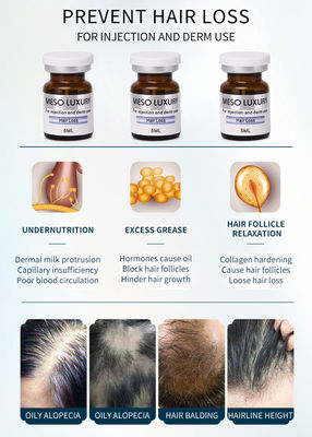 Anti trattamento di lusso dell'iniezione di Mesotherapy del siero di perdita di capelli per crescita dei capelli