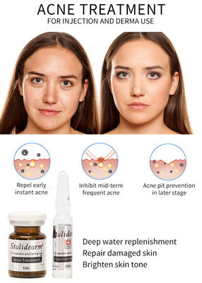 Siero Mesotherapy dell'iniezione di trattamento dell'acne di Stalidearm che non nutrisce effetti collaterali