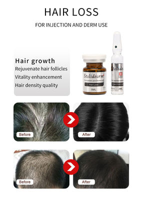 Siero di esosomi per capelli iniettabili Francia Soluzione originale di mesoterapia per la crescita dei capelli Stalidearm