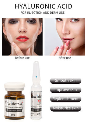 Microneedling antinvecchiamento acido ialuronico dell'iniezione 5ml del siero della gioventù