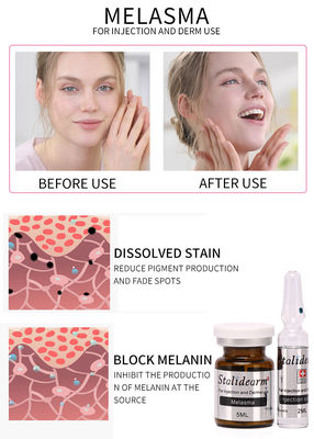 Cassaforte del siero di uso dell'iniezione di Melasma e buon insieme del siero di Mesotherapy 5ml/bottle di effetto