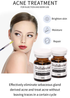 L'iniezione del siero dell'essenza del trattamento dell'acne usa Theraphy che meso il buon siero sicuro di effetto ha messo 5pcs/Set