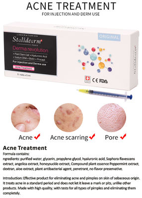 L'iniezione del siero dell'essenza del trattamento dell'acne usa Theraphy che meso il buon siero sicuro di effetto ha messo 5pcs/Set