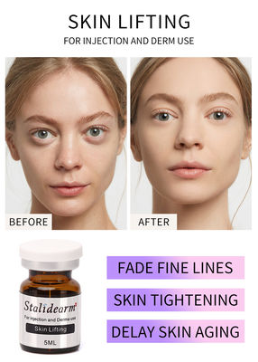 Esosomi Skin Booster Stalideram Anti-età Soluzione iniettabile per mesoterapia per il sollevamento cutaneo